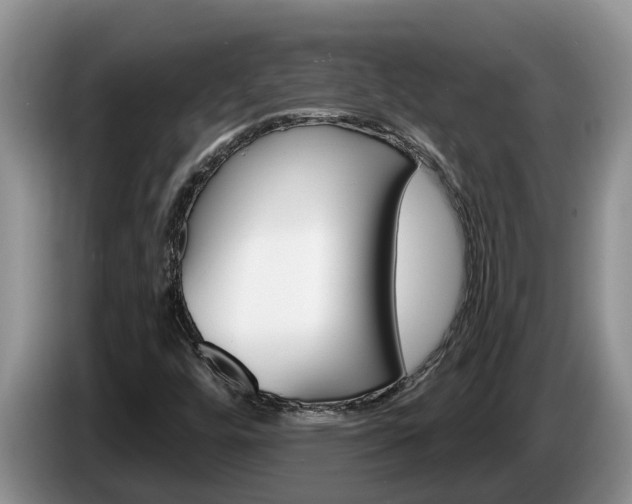 X0000087571448200704270935