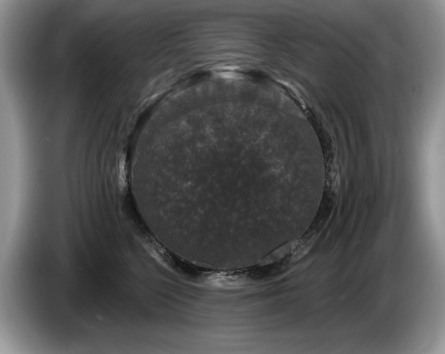 X0000087570568200704271249