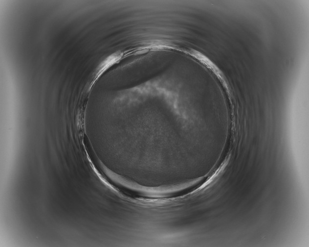 X0000087571385200704271239