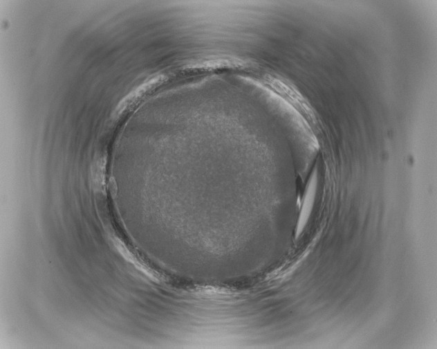 X0000087570585200705112215