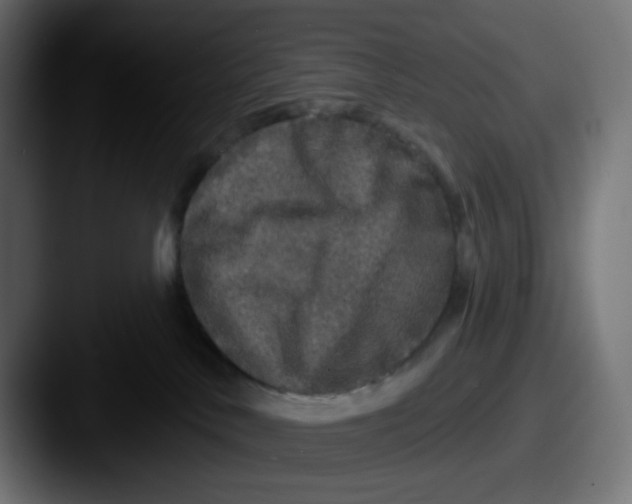 X0000087570042200705181150