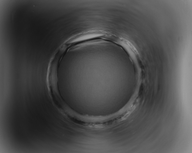 X0000087570156200705181149