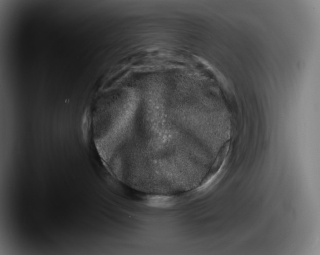 X0000087570192200705181149