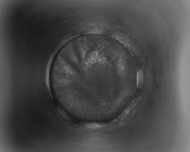 X0000087570195200705181149