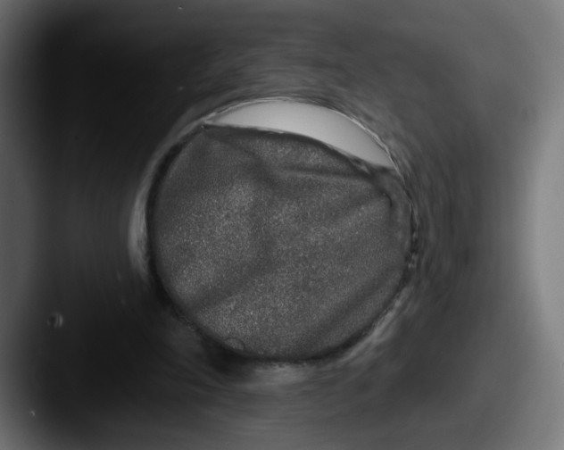 X0000087570198200705181149