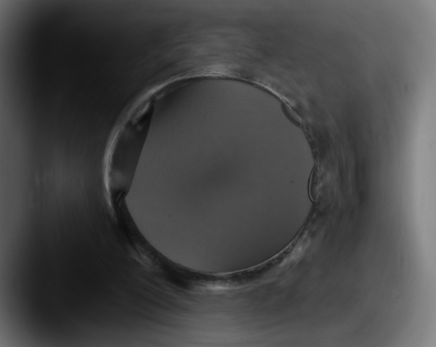 X0000087570200200705181149