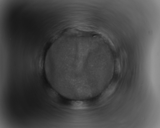 X0000087570230200705181148