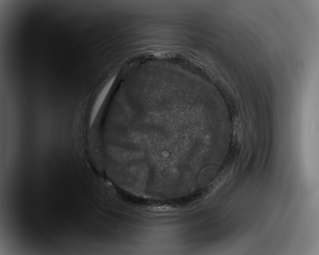 X0000087570650200705181143