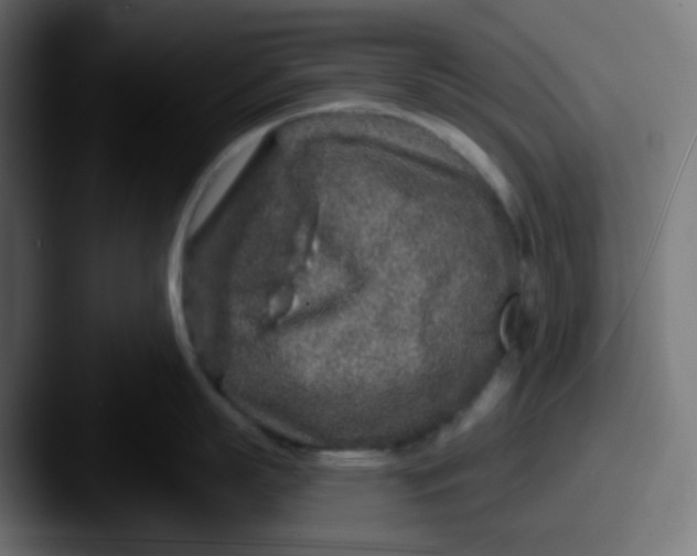 X0000087570863200705181141