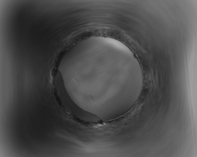 X0000087571013200705181139