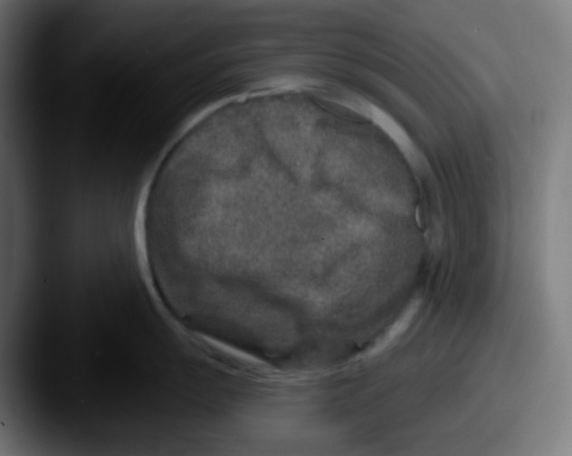 X0000087571055200705181139