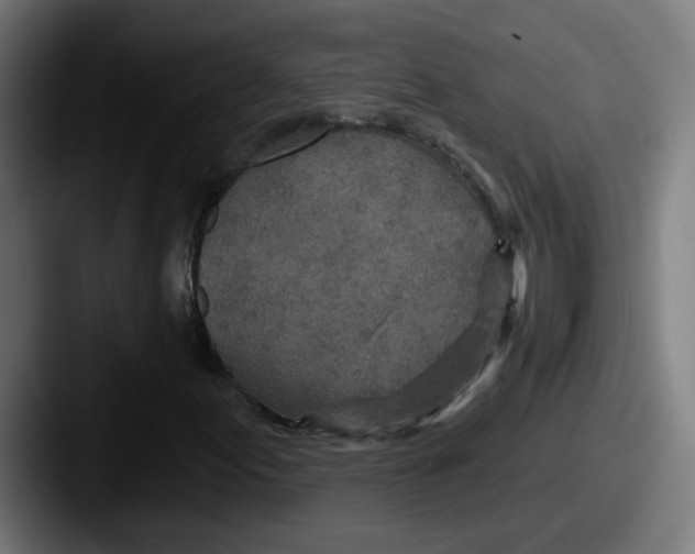 X0000087571155200705181137