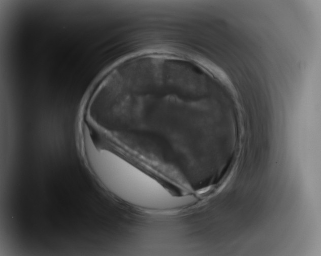 X0000087571200200705181137