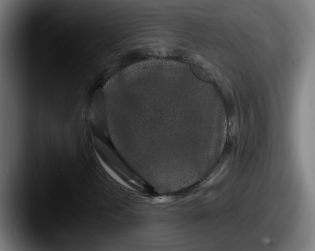 X0000087571202200705181136