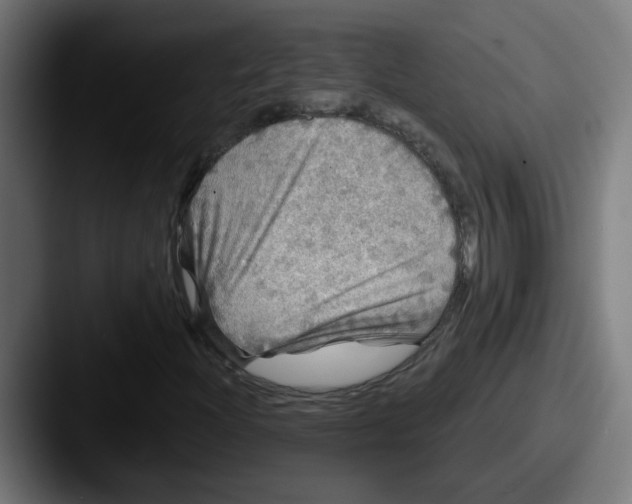 X0000087571204200705181136