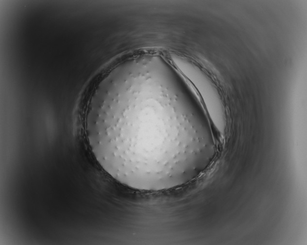 X0000087571208200705181136