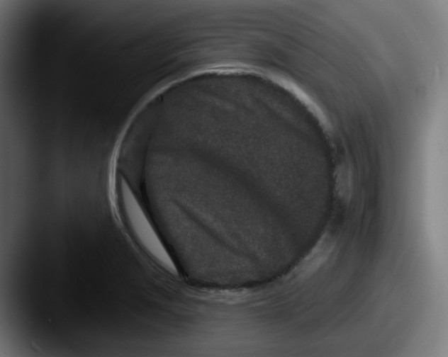 X0000087571229200705181137