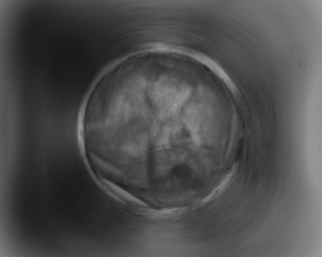 X0000087571247200705181137