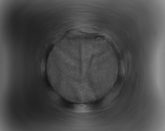 X0000087570230200705251827