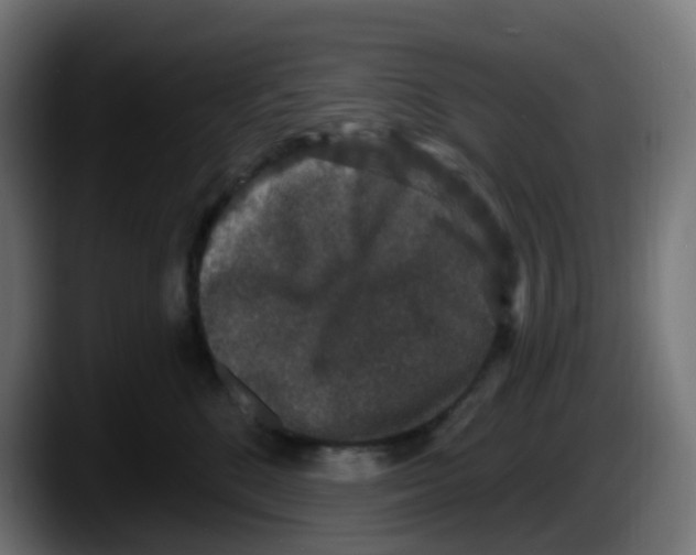 X0000087570520200705251823