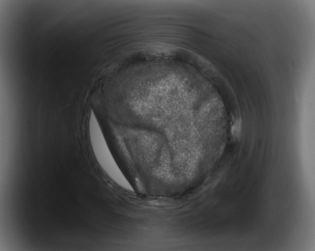 X0000087570819200705251818