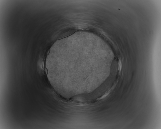 X0000087571155200705251814