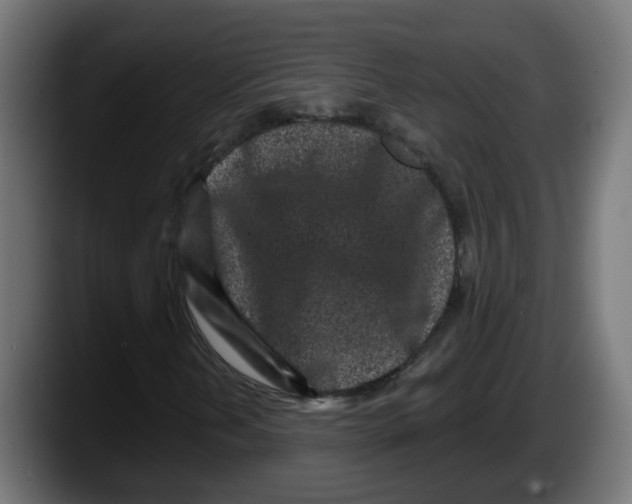 X0000087571202200705251813