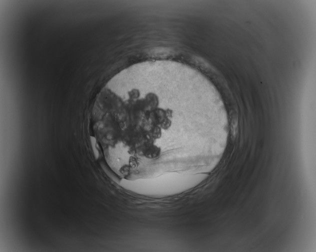 X0000087571204200705251813