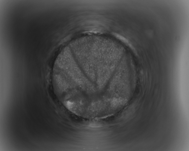 X0000087571399200705251811