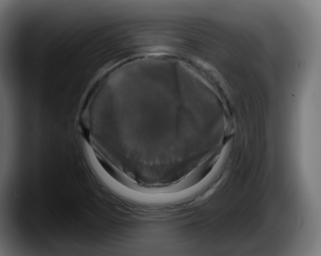 X0000087571457200705251811