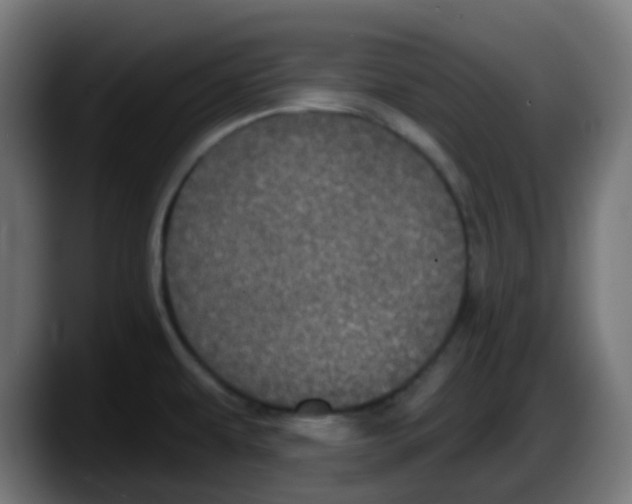 X0000087571479200705251810