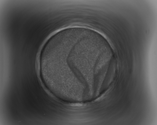 X0000087571515200705251810