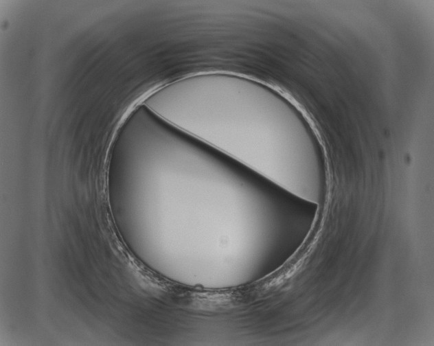 X0000087581145200704271038