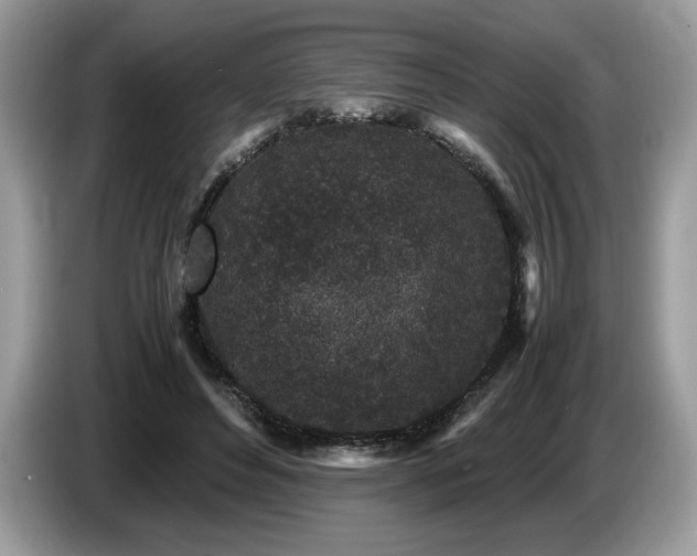 X0000087580496200704271307