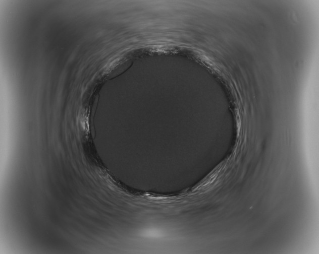 X0000087581155200704271300