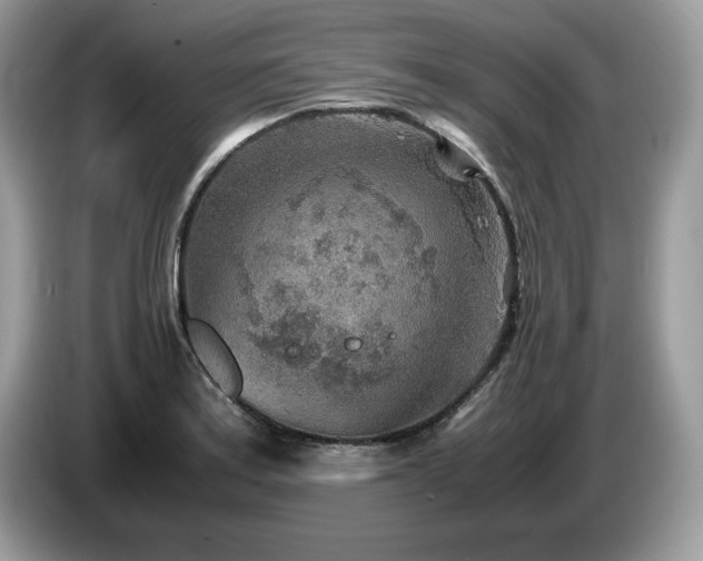 X0000087581179200704271300