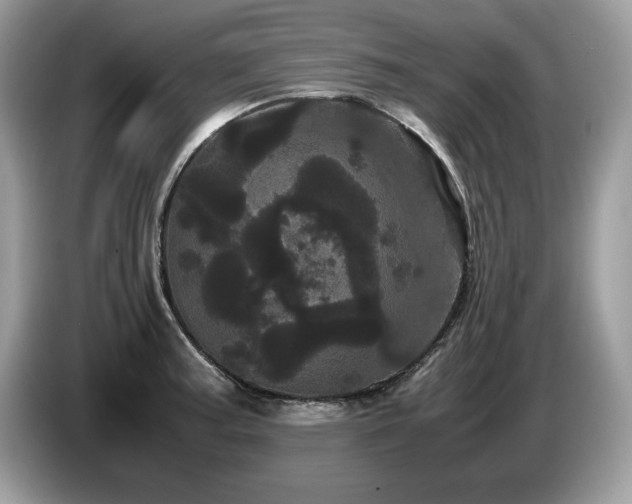 X0000087581187200704271259