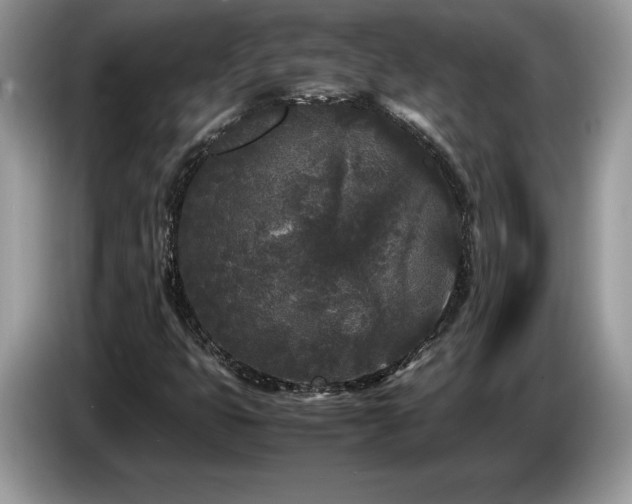 X0000087581399200704271257
