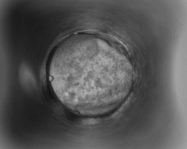 X0000087580198200705181207