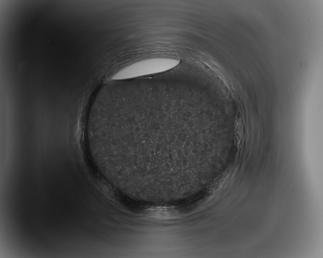 X0000087580499200705181203
