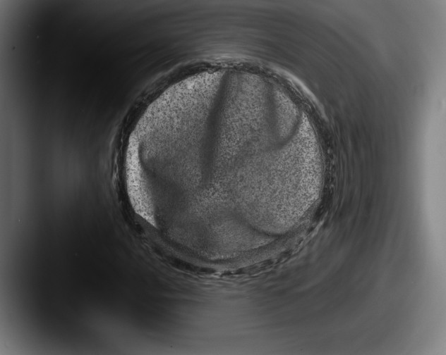 X0000087581016200705181157