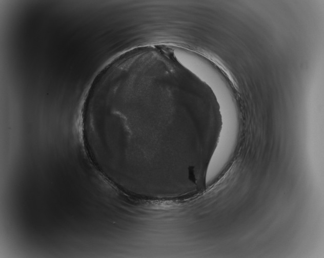 X0000087581024200705181157