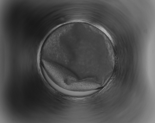 X0000087581140200705181156