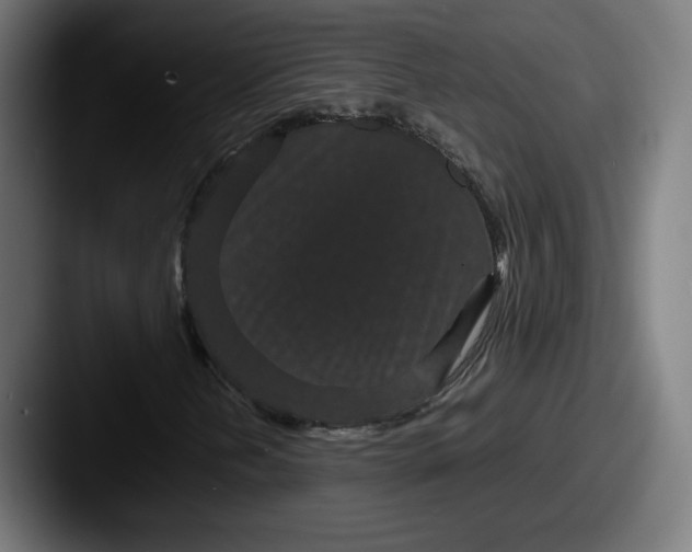 X0000087581202200705181155
