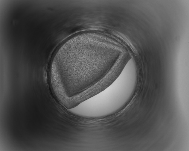 X0000087581260200705181155