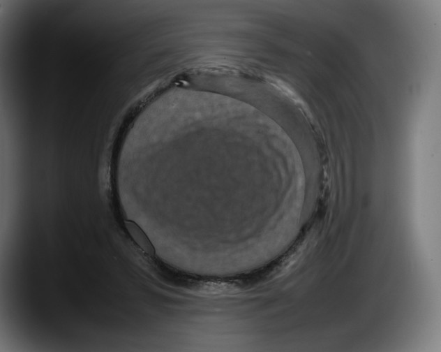 X0000087580399200705251845