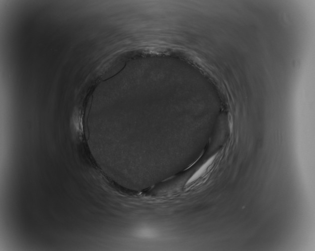 X0000087581155200705251835
