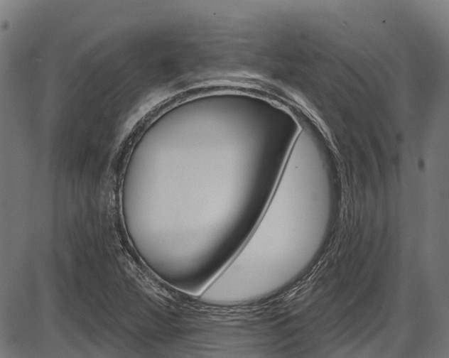X0000087591360200704271100