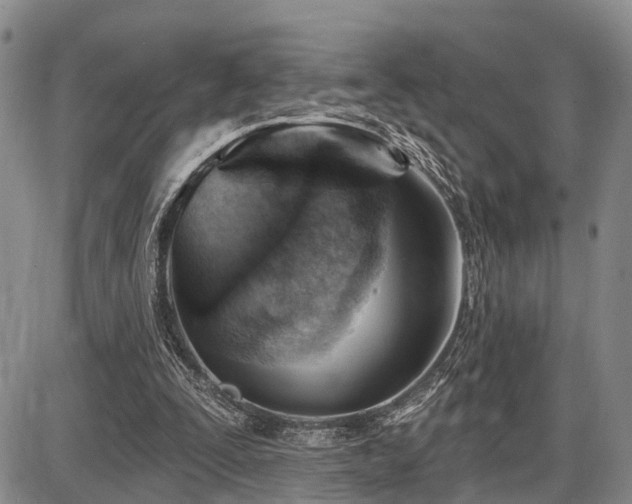 X0000087590295200704271314