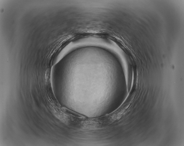 X0000087591300200704271257